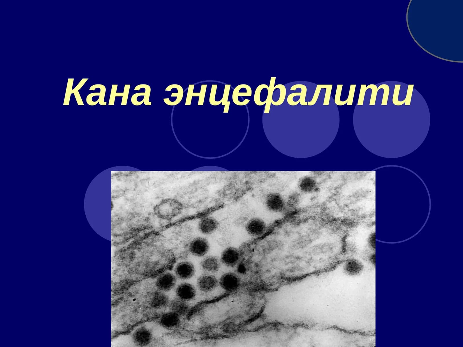 Канаэнцефалити