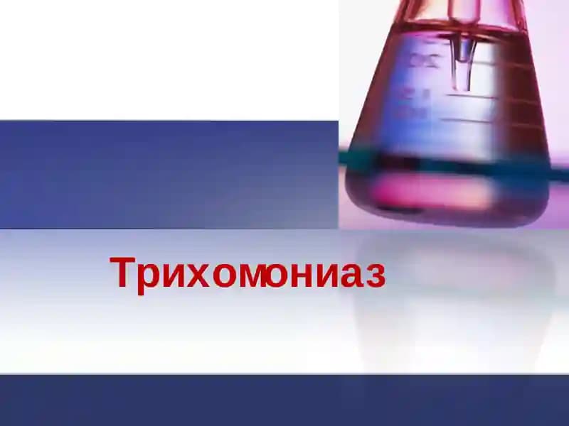 Трихомониаз