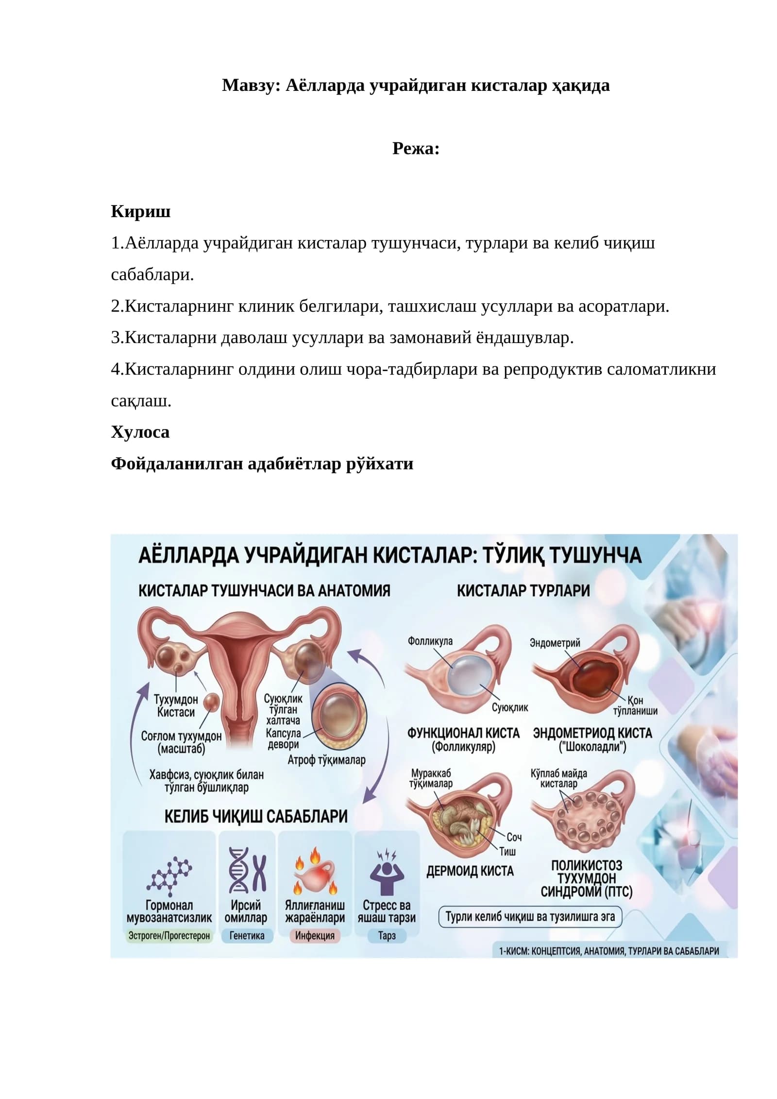 Аёлларда учрайдиган кисталар ҳақида