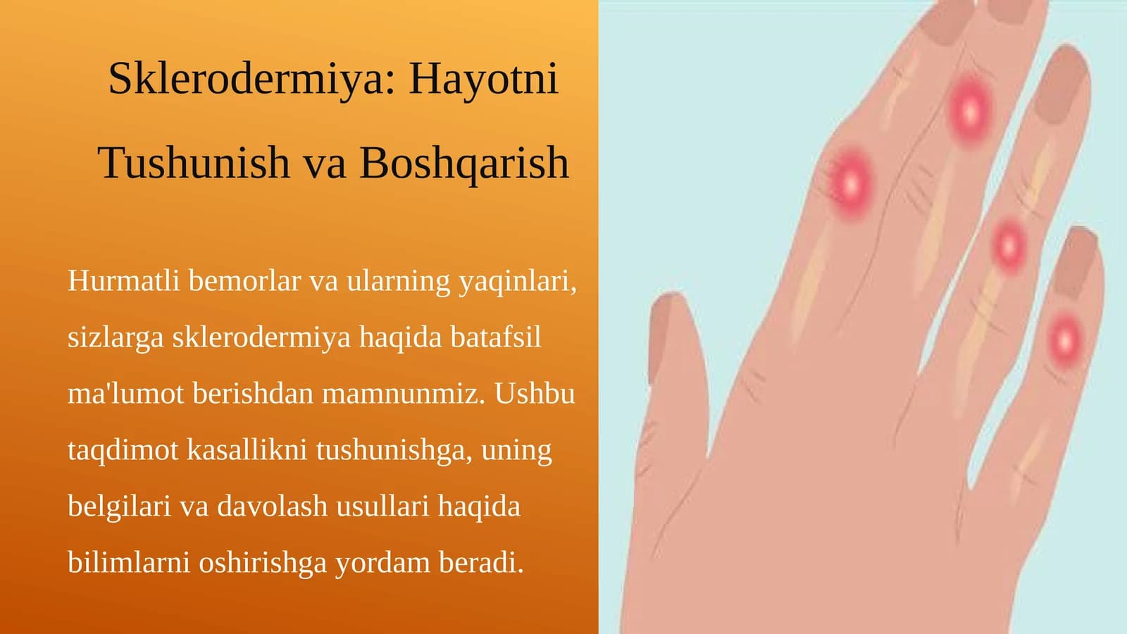 Sklerodermiya: Hayotni Tushunish va Boshqarish