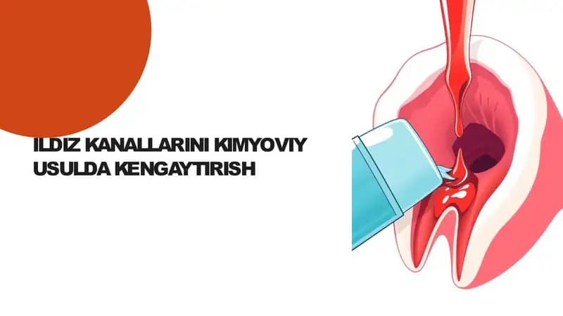 ILDIZ KANALLARINI KIMYOVIY USULDA KENGAYTIRISH