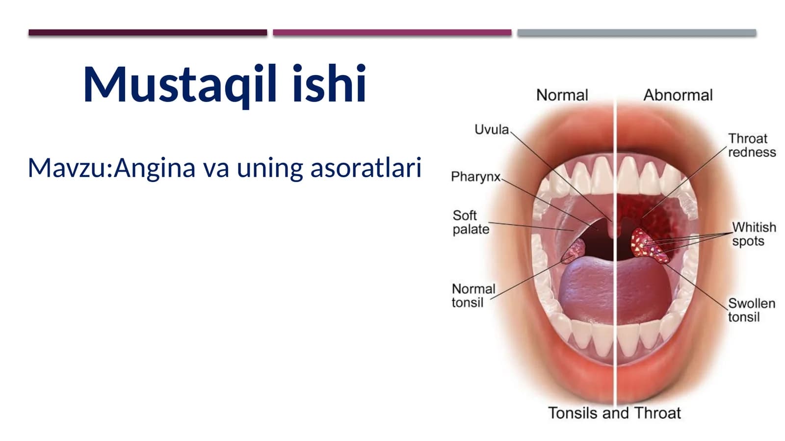 Angina va uning asoratlari