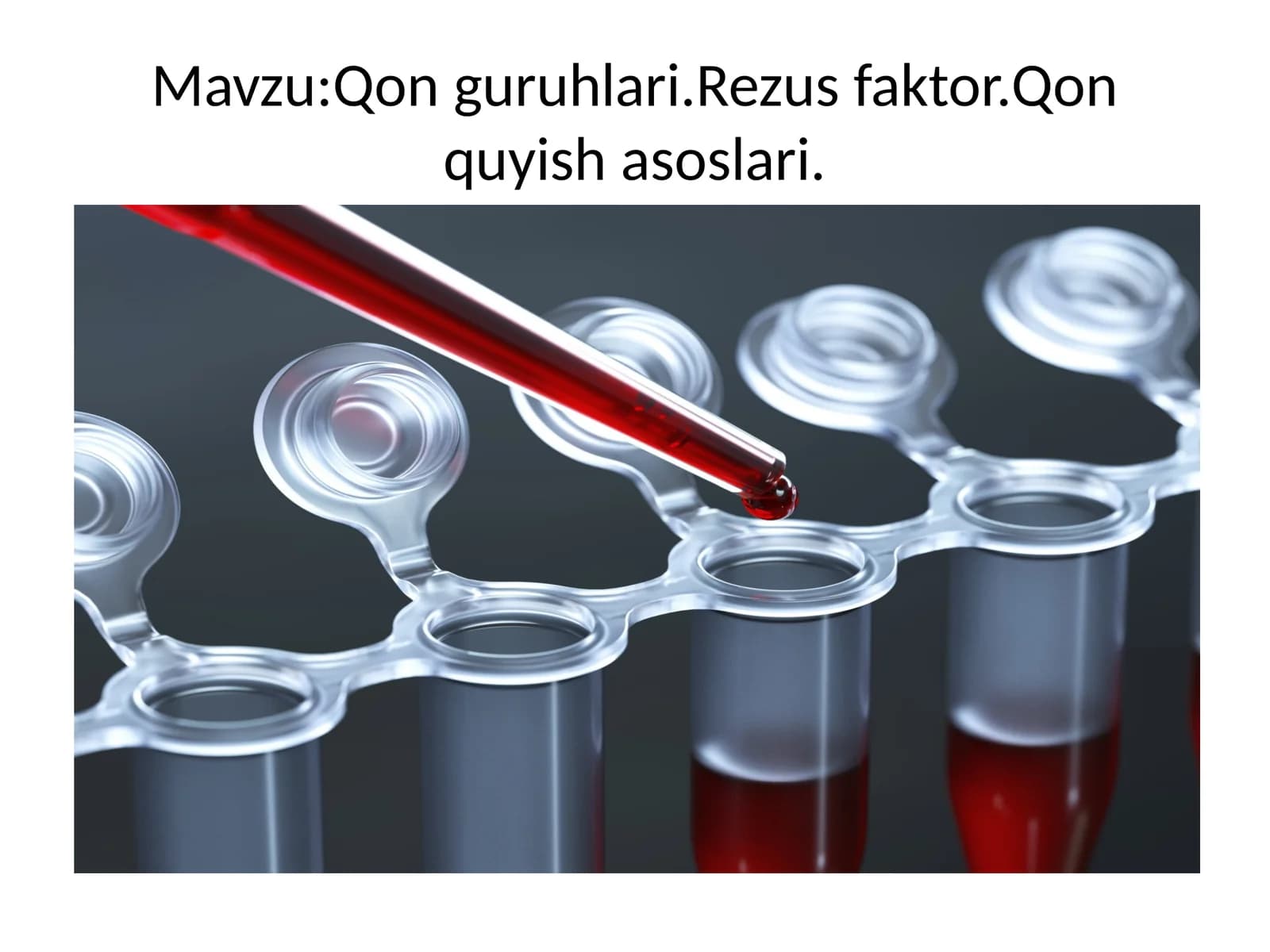 Qonguruhlari.Rezusfaktor.Qonquyishasoslari