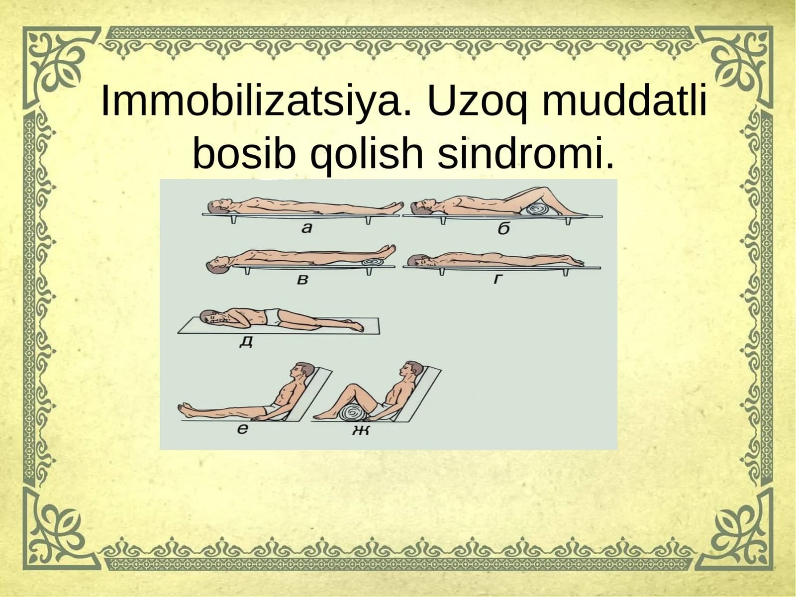 Immobilizatsiya.Uzoq muddatli bosib qolish sindromi