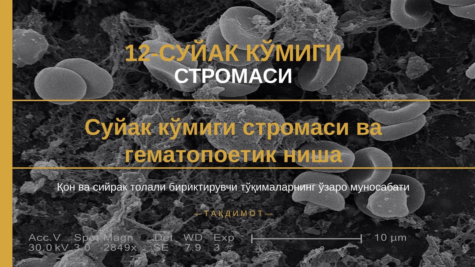 12-СУЙАК КЎМИГИ