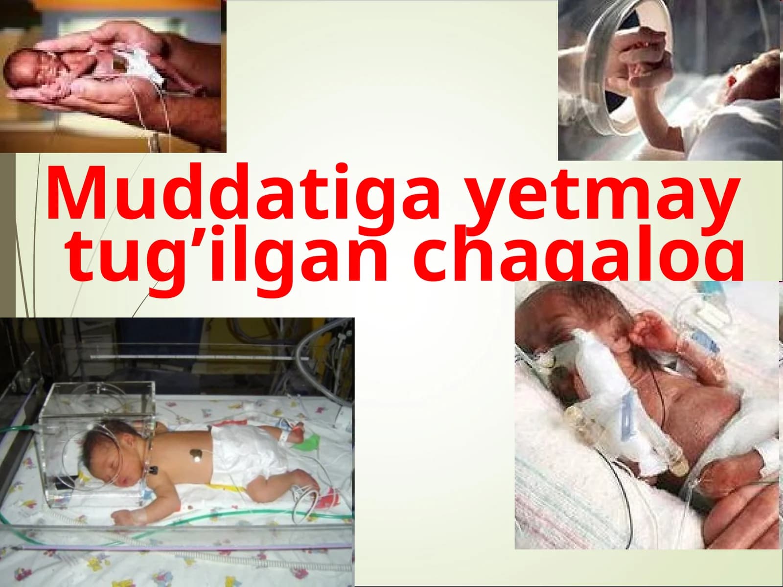 Muddatigayetmay tug’ilgan chaqaloq