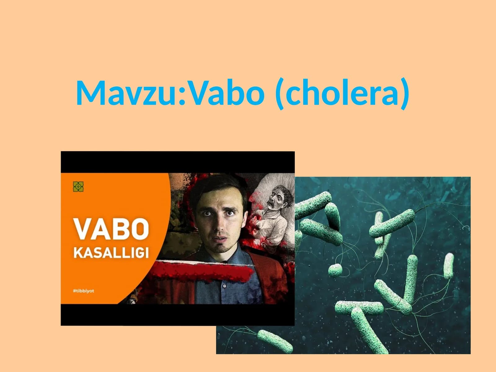 Vabo (cholera)