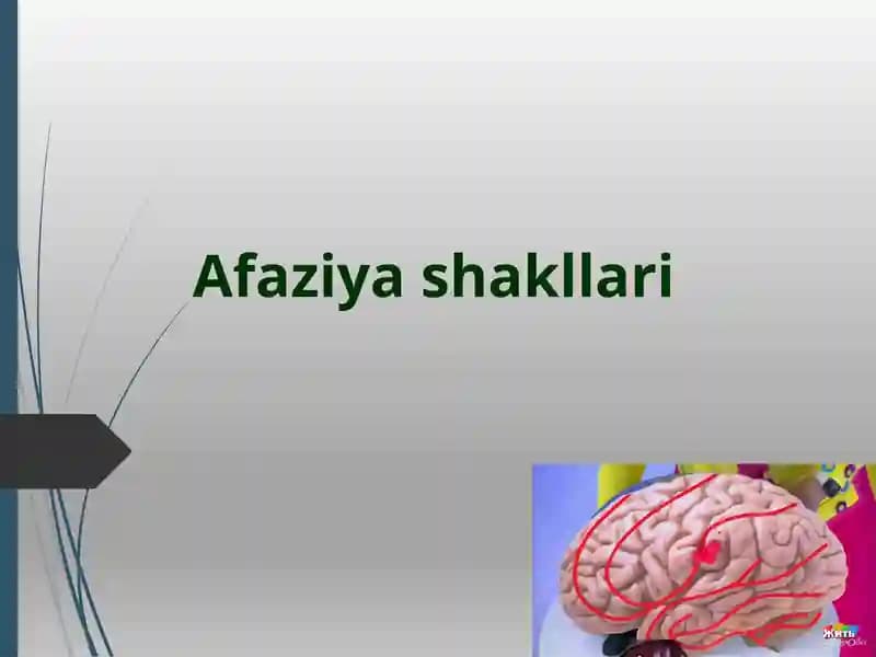Аfaziya klassifikatsiyalari