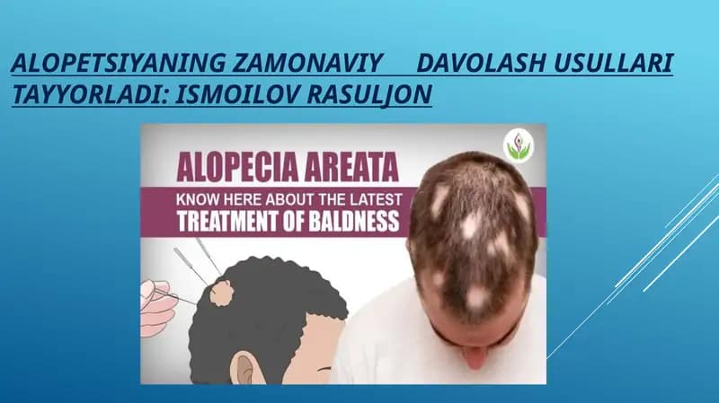 ALOPETSIYANING ZAMONAVIY DAVOLASH USULLARI