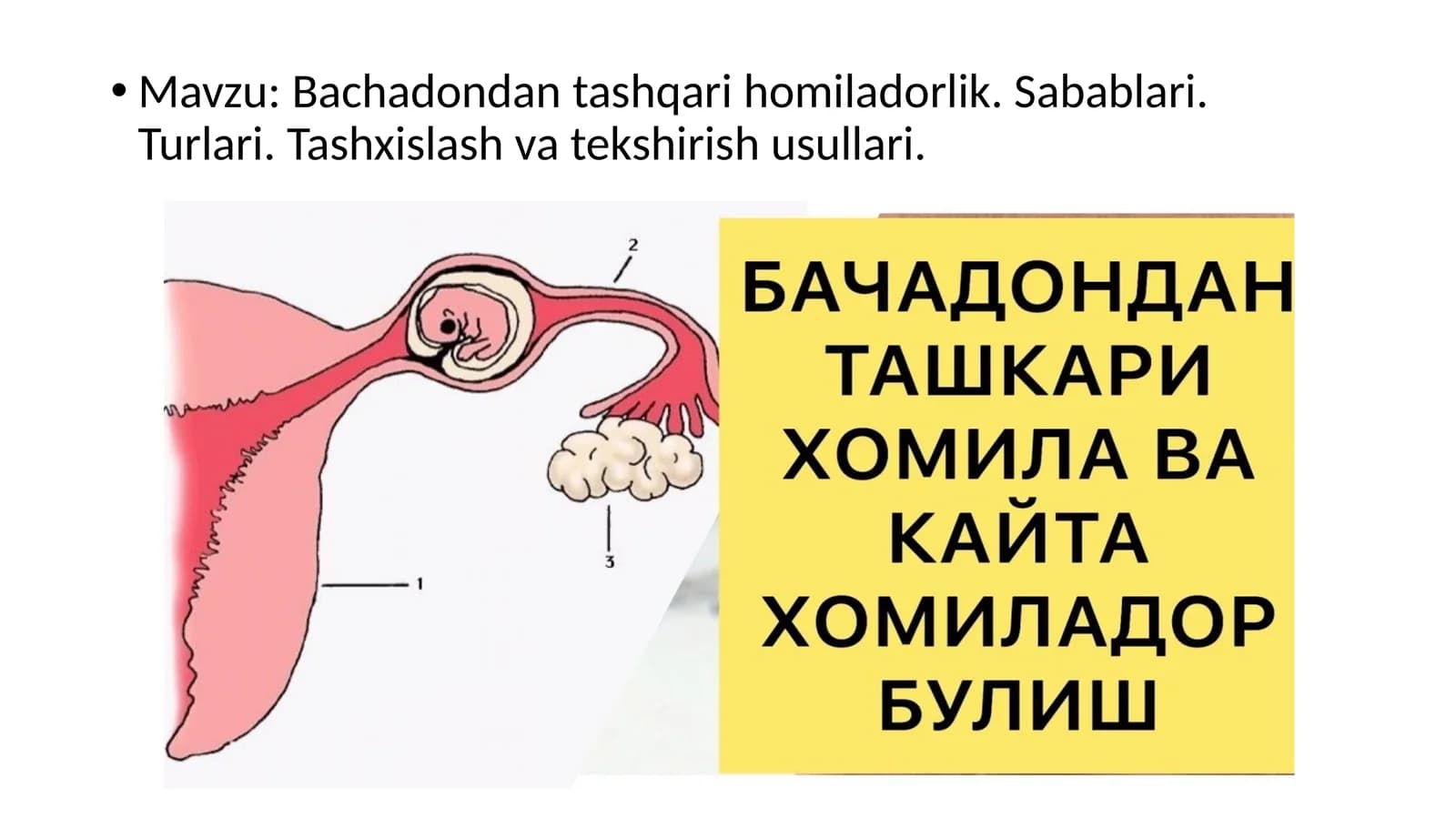 Bachadon-dantashqari homiladorlik