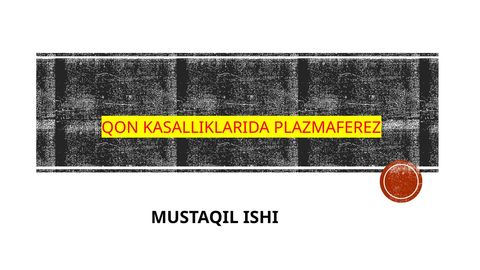 qon kasalliklari daplazmaferez