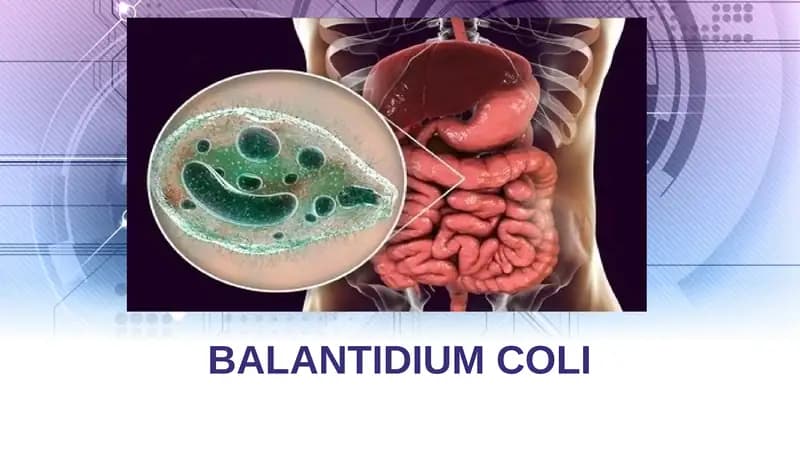 Balantidiaz. Yuqumli kasalliklar