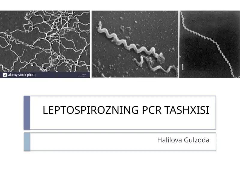 LEPTOSPIROZNING PCR TASHXISI