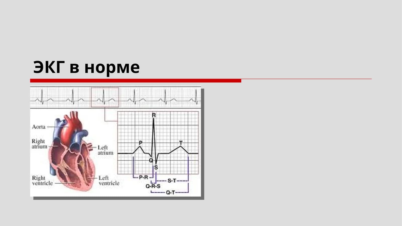 ЭКГ в норме