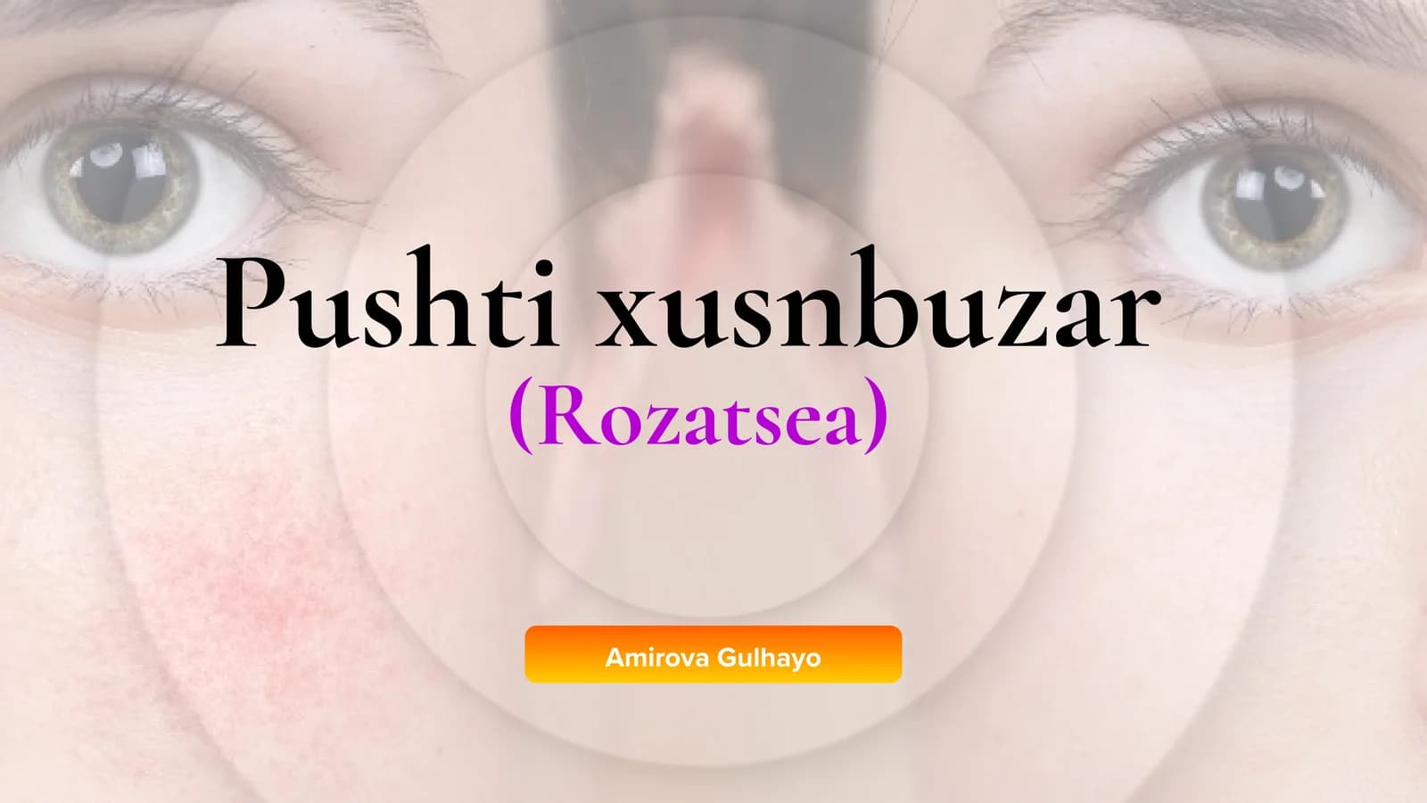 Pushti xusnbuzar (Rozatsea)