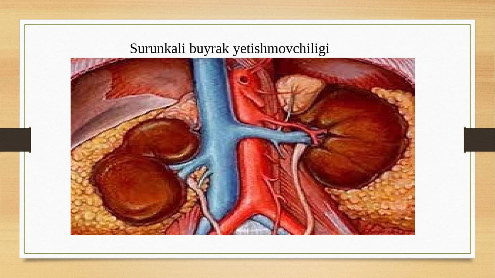 Surunkali buyrak  yetishmovchiligi