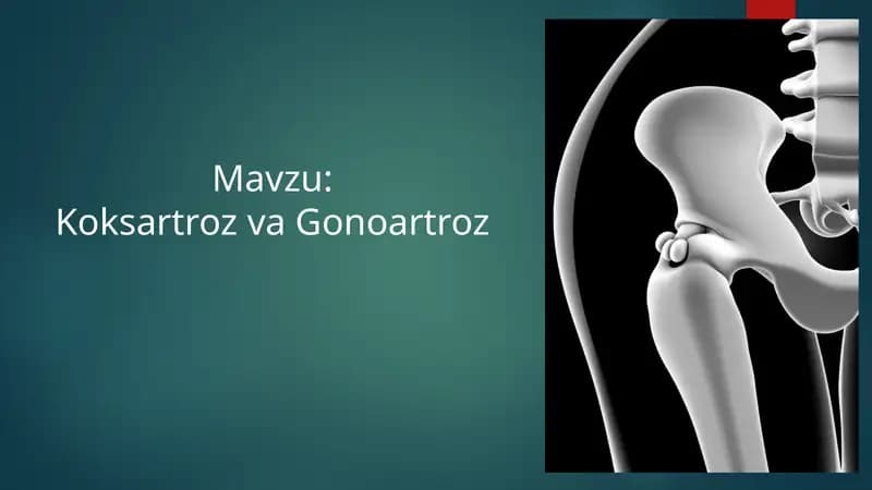 TOS-SON BO'G'IMI ANATOMIYASI Koksartroz va Gonoartroz