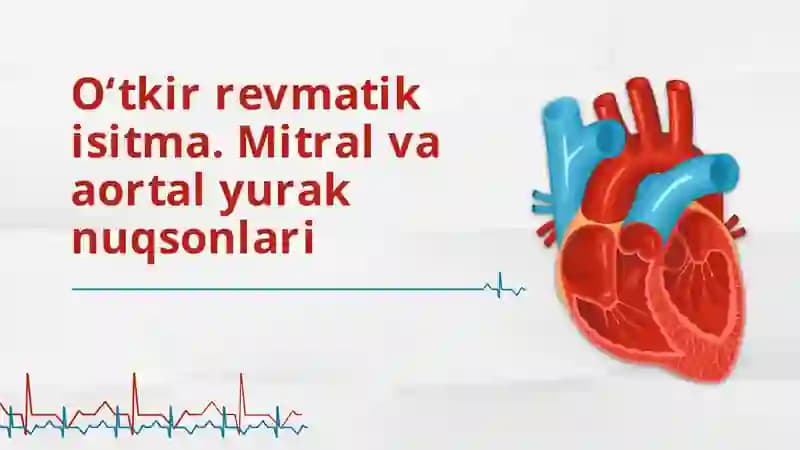O‘tkir revmatik isitma. Mitral va aortal yurak nuqsonlari