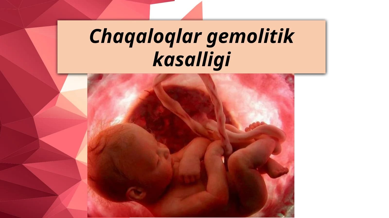 Chaqaloqlar gemolitik kasalligi