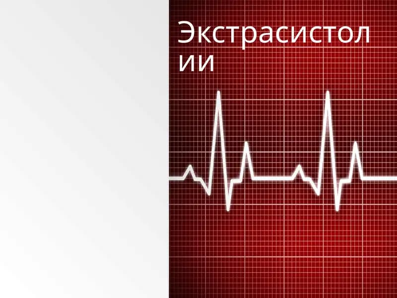 Ekstrasistoliya