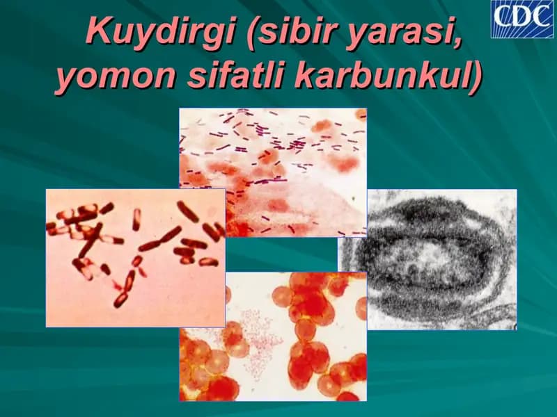 Kuydirgi (sibir yarаsi, yomоn sifаtli kаrbunkul)
