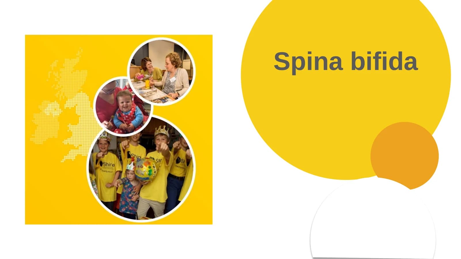 Spinabifida