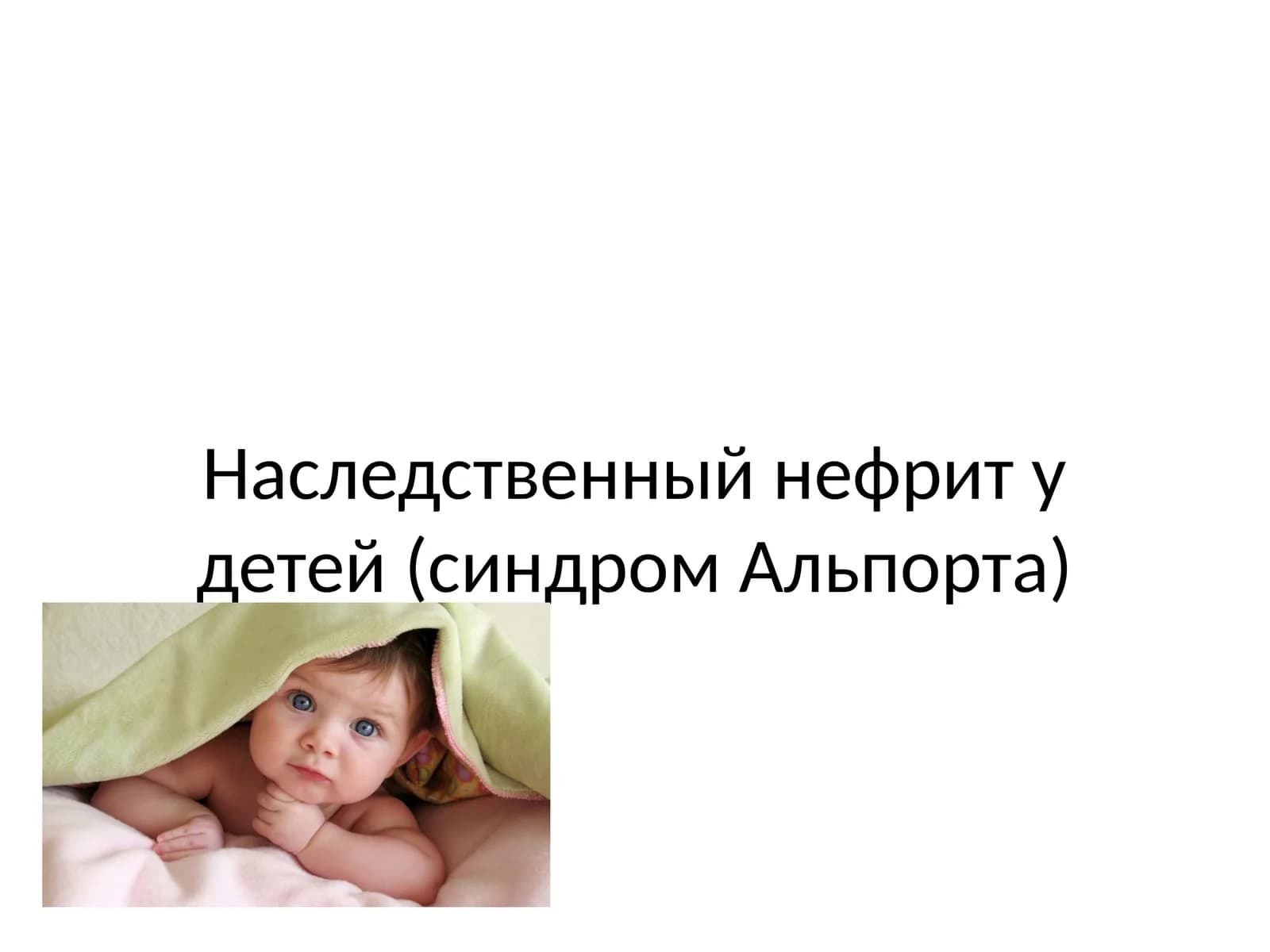 Наследственный нефрит у детей (синдром Альпорта)