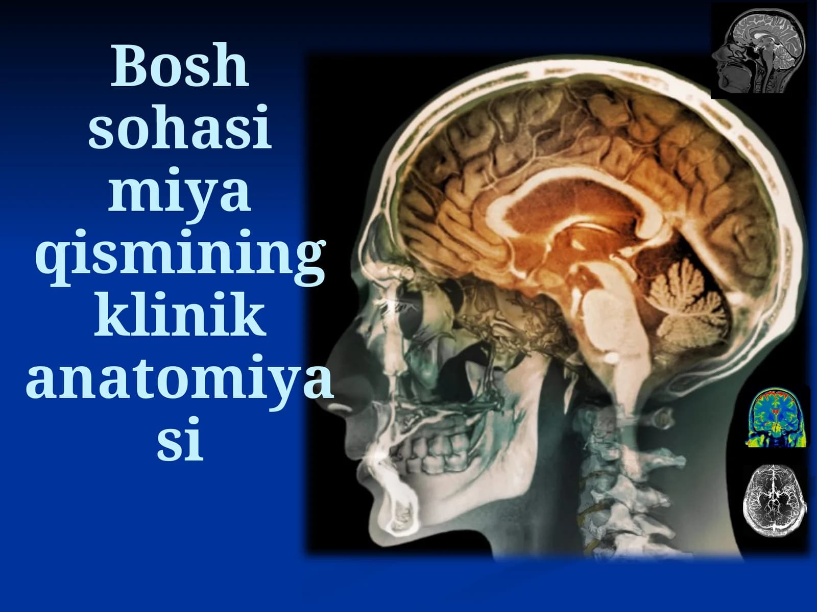 Bosh sohasi miya qismining klinik anatomiyasi