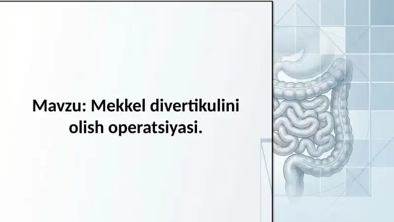 Mekkel divertikulini olish operatsiyasi