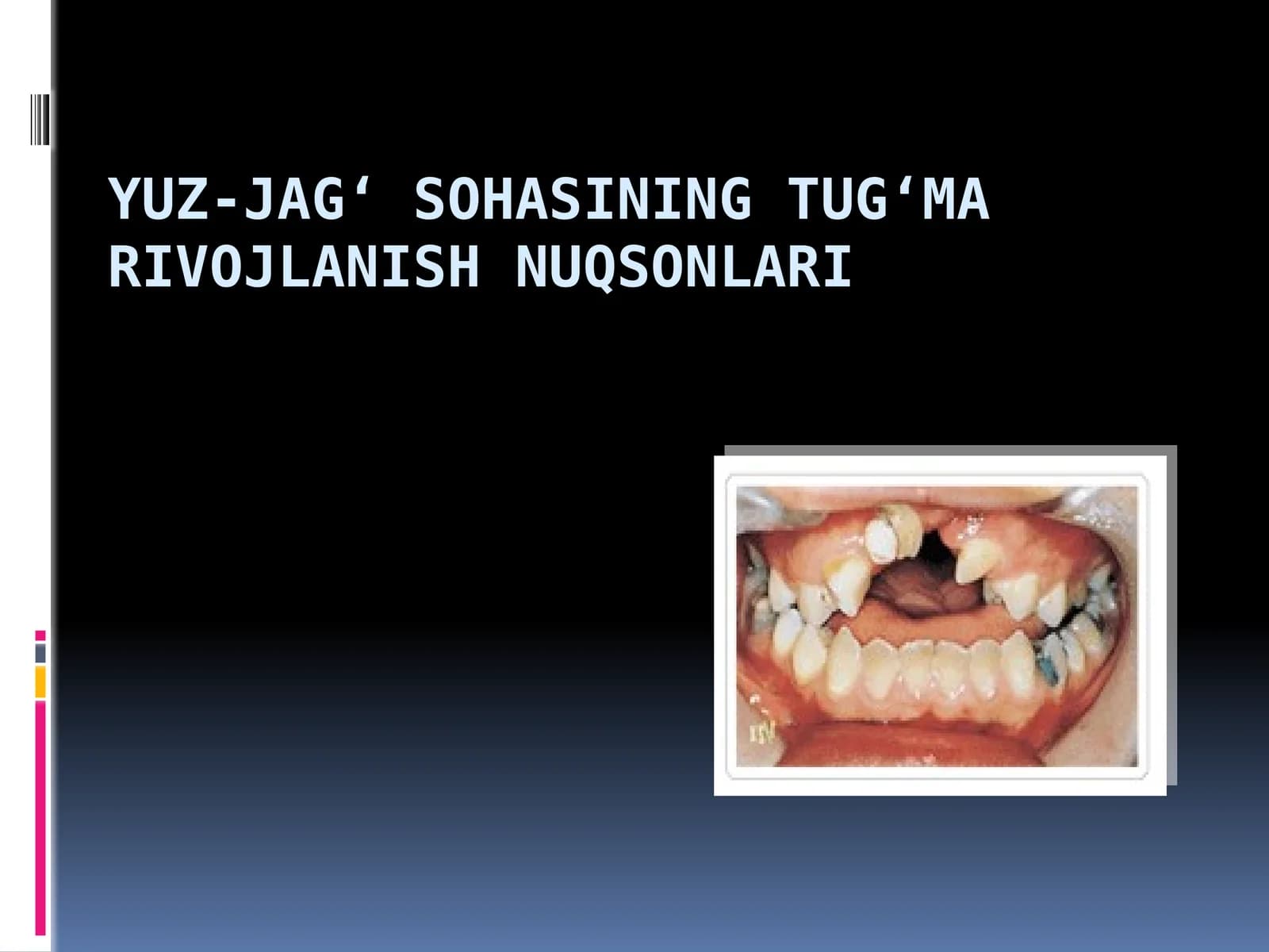 YUZ-JAG‘ SOHASINING TUG‘MA  NUQSONLARI xirurgiyasi