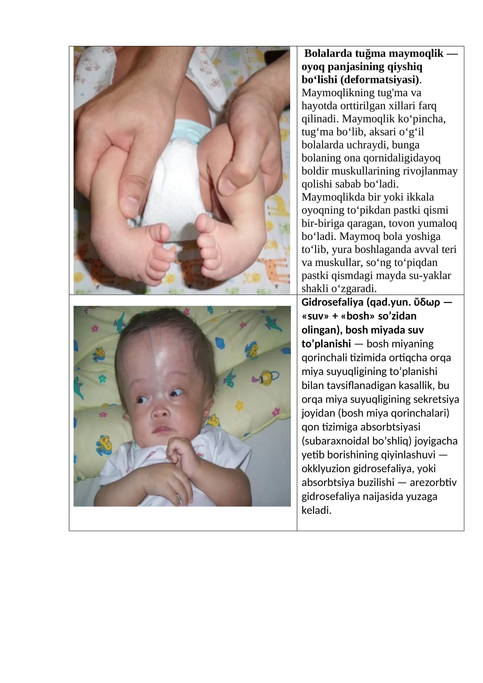 Bolalarda tuğma maymoqlik