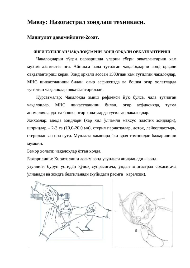 Назогастрал зондлаш техникаси