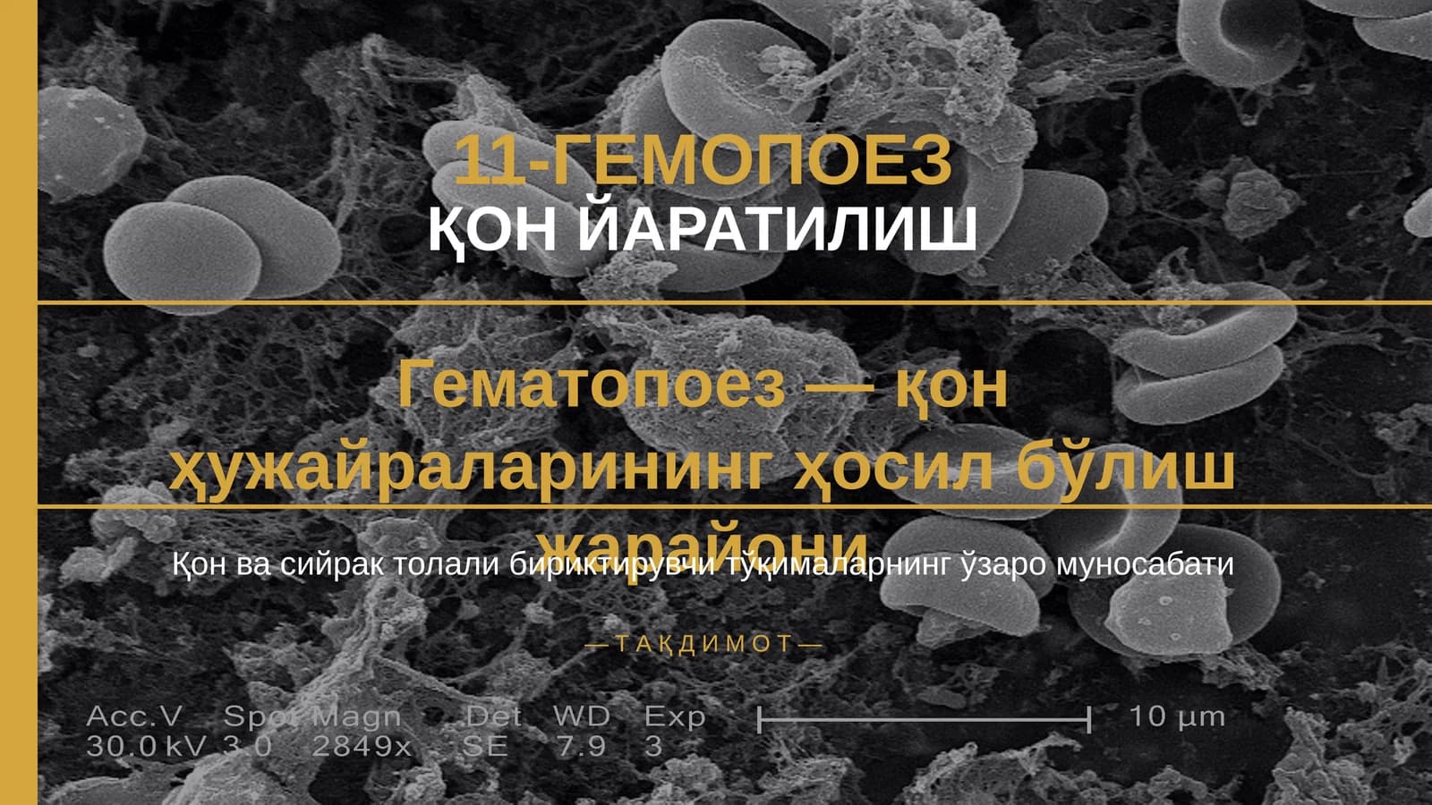 11-ГЕМОПОЕЗ