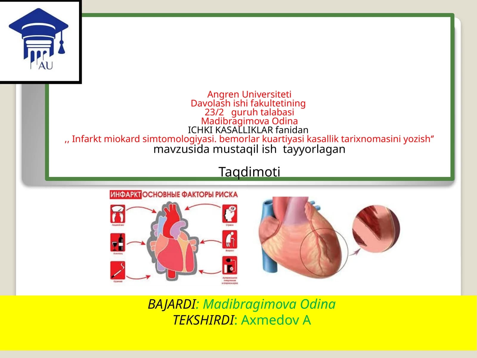 Infarkt miokard simtomologiyasi