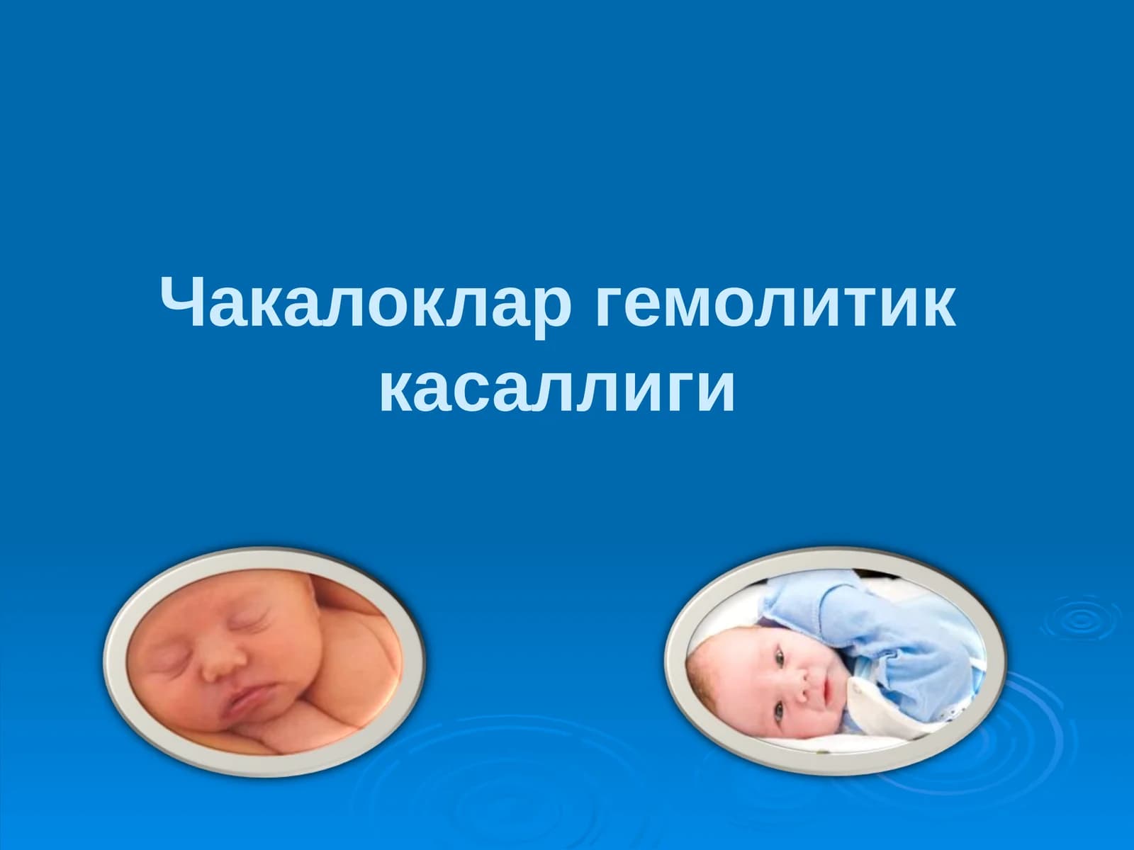 Чакалоклар гемолитиккасаллиги