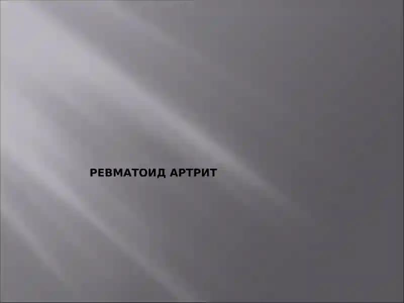 Ревматоид артрит