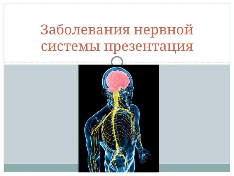Заболевания нервной системы презентация