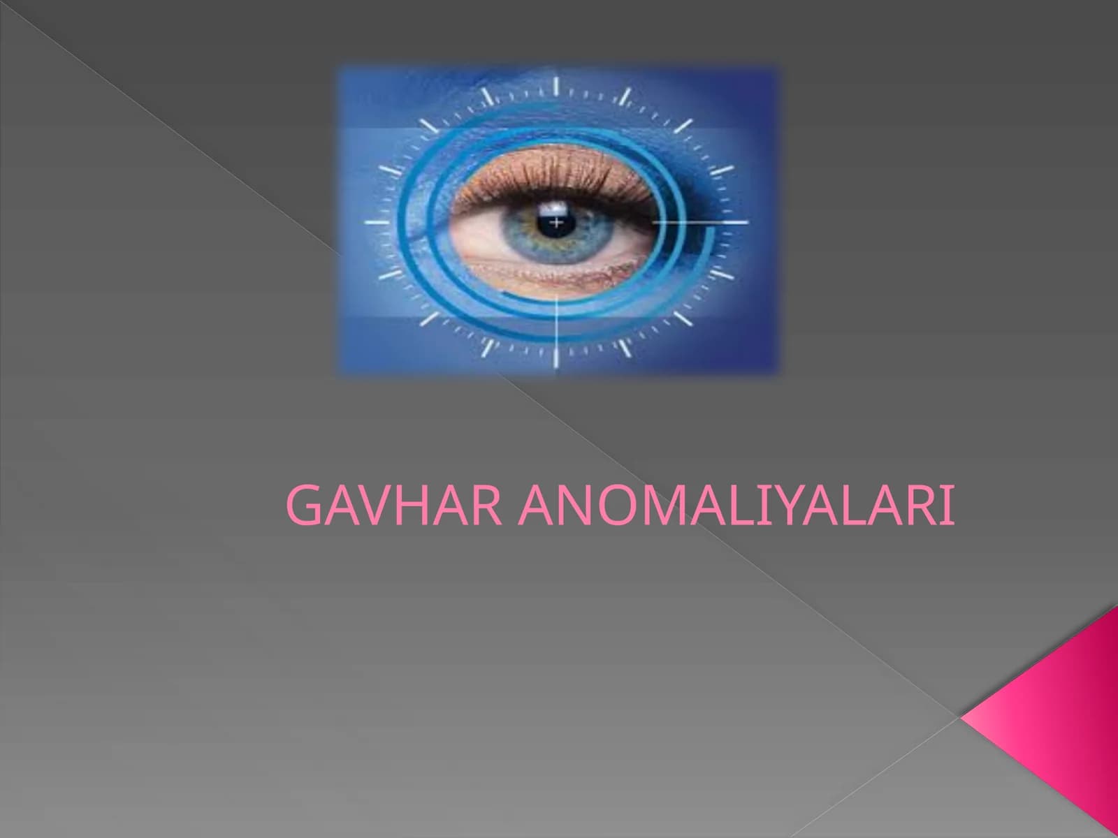 GAVHAR ANOMALIYALARI