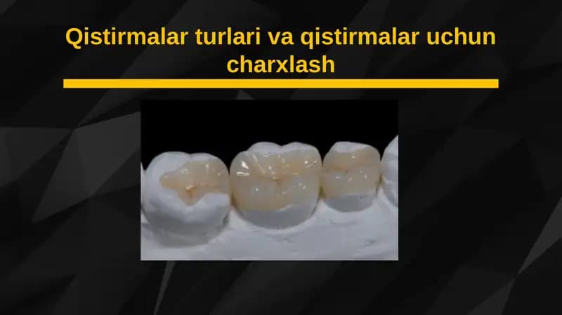 Qistirmalar turlari va qistirmalar uchun charxlash