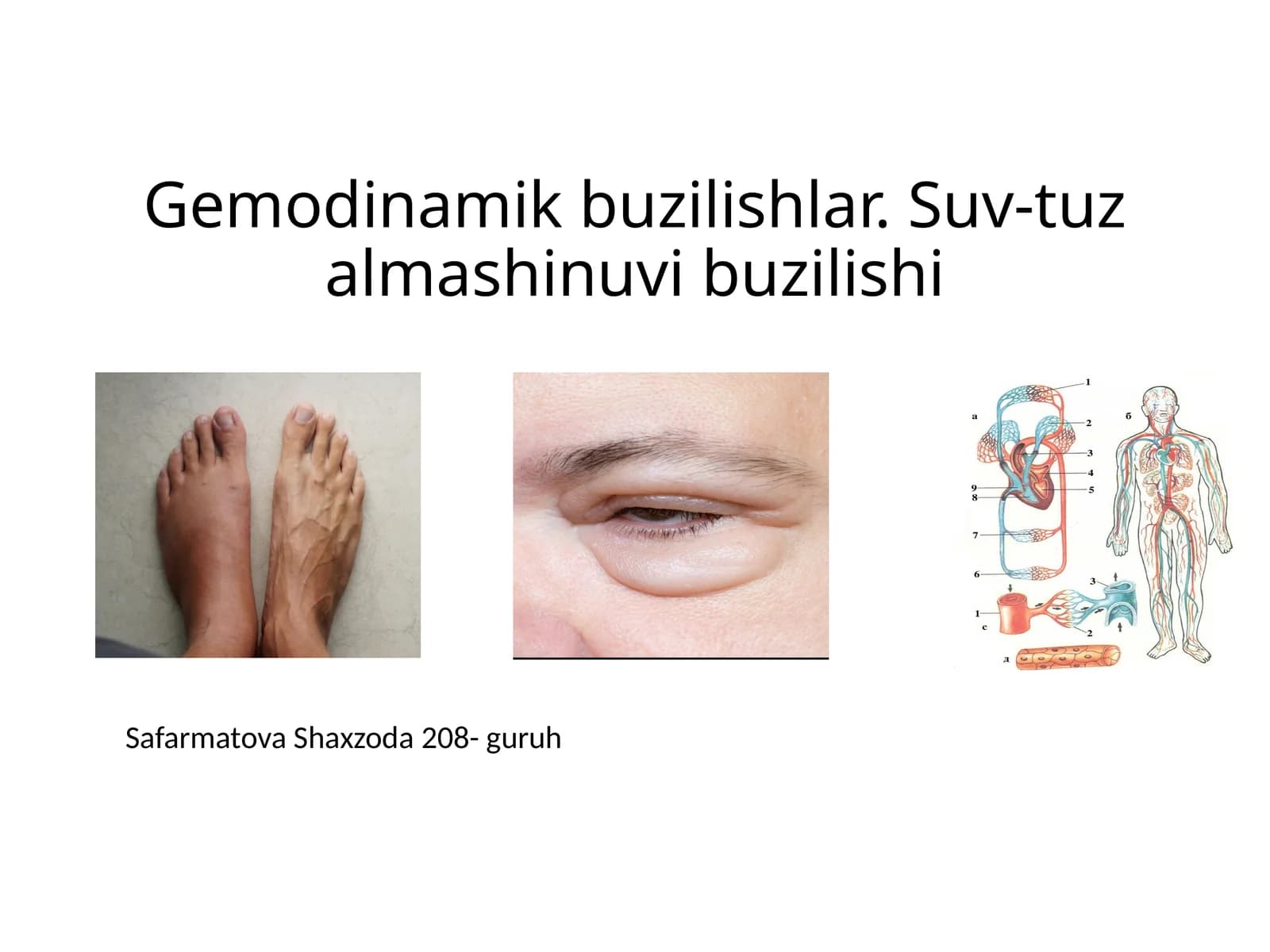 Gemodinamik buzilishlar