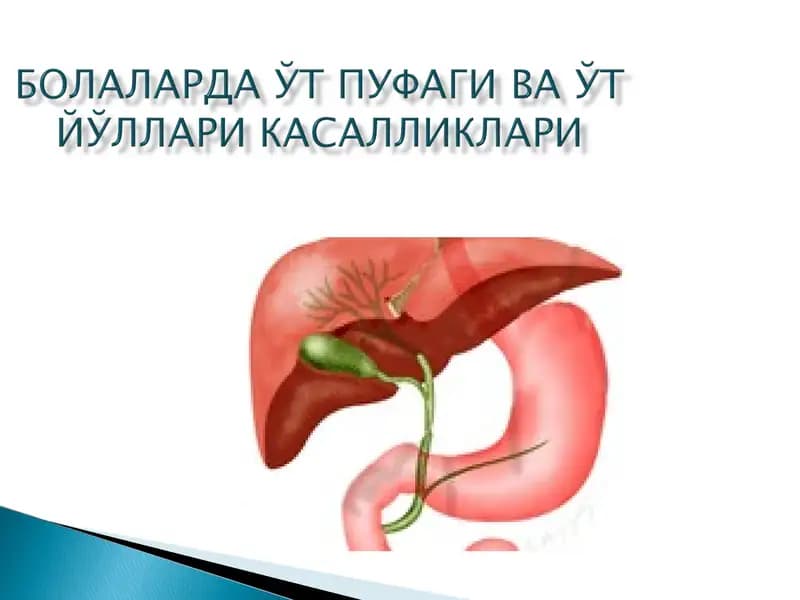 Холецистит