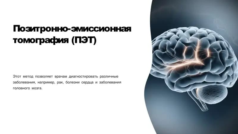 Позитронно-эмиссионная томография (ПЭТ)