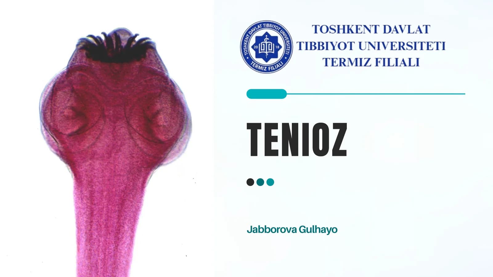 Tenioz