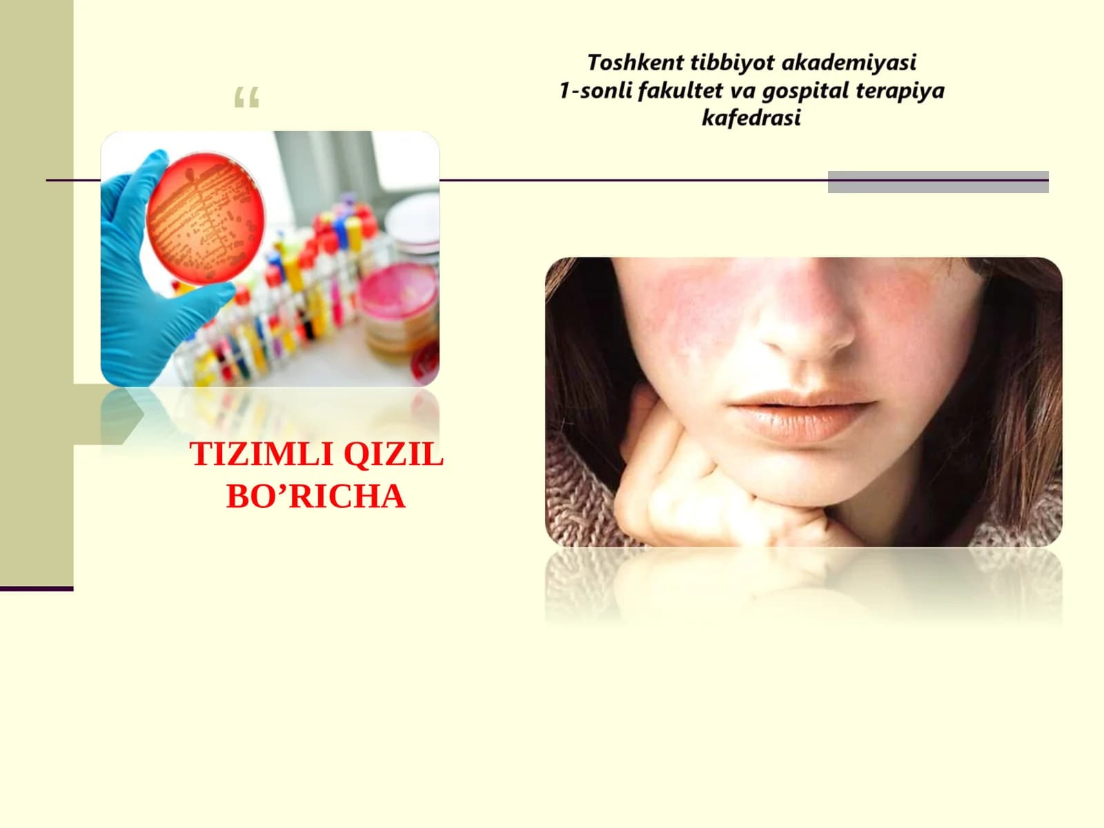 TIZIMLI QIZIL BO’RICHA