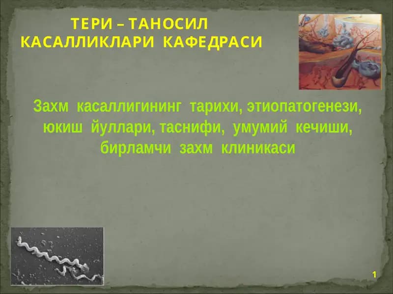 Таносил касалликлари