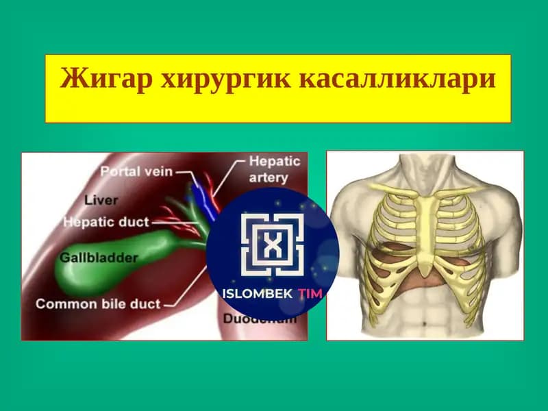 Жигар хирургик касалликлари