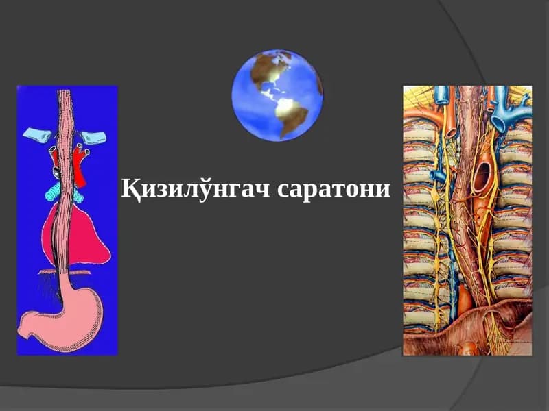 Қизилўнгач саратони