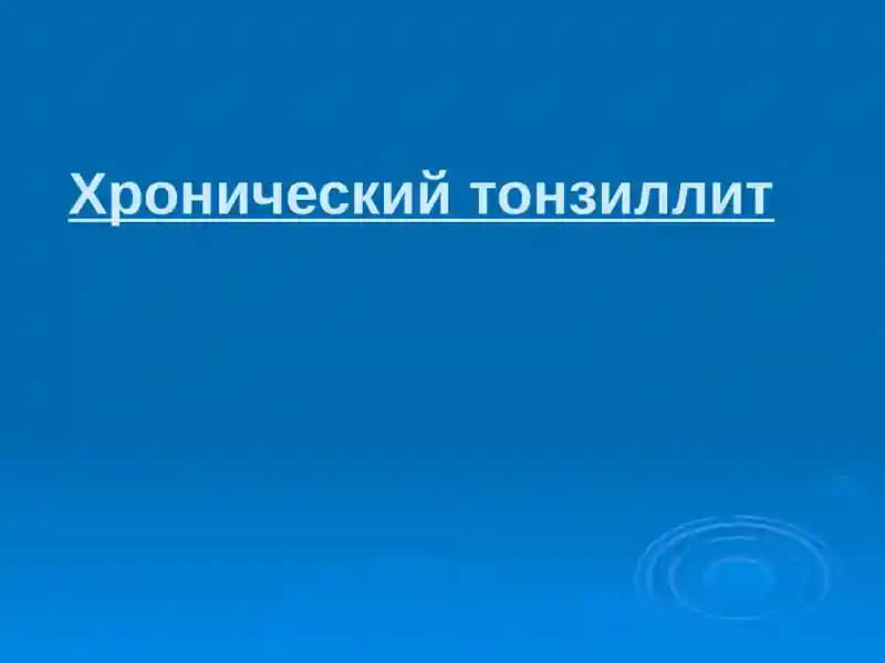 Хронический тонзиллит