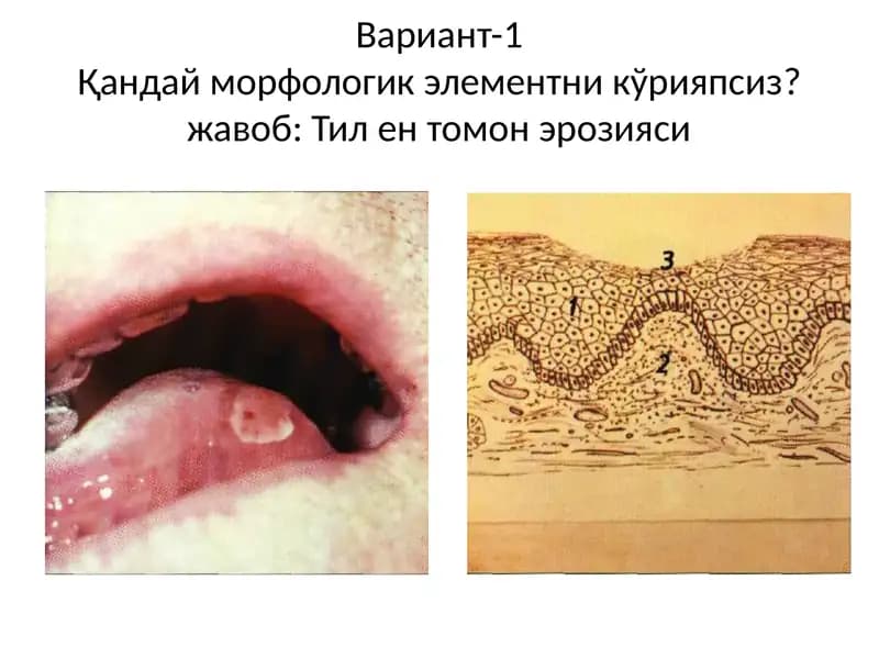 Расмдани маник ўрияпсиз