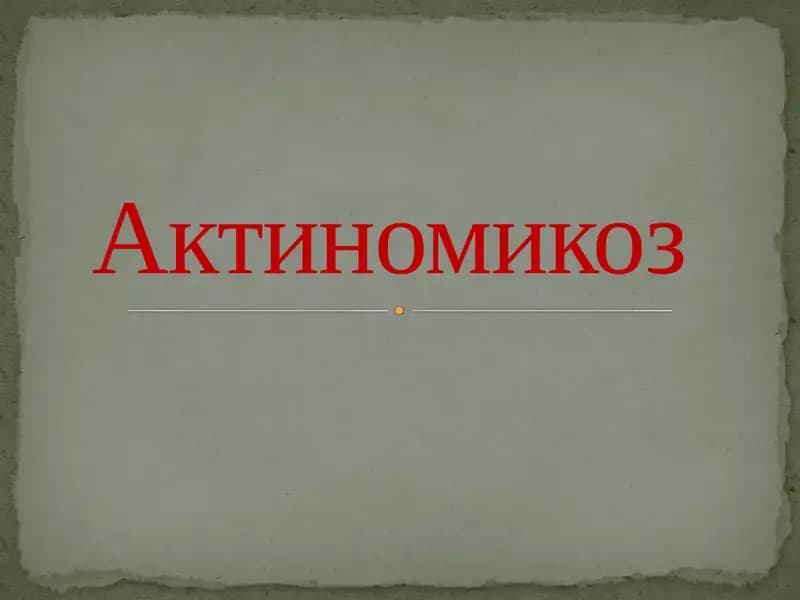 Актиномикоз
